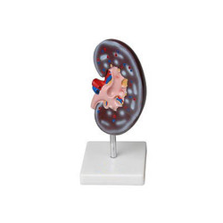 Модель почки в разрезе